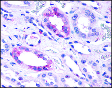 Anti-GPR146 antibody produced in rabbit