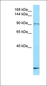 Anti-FBXO11 antibody produced in rabbit