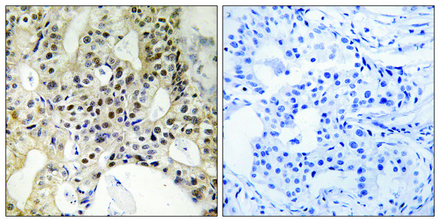 Anti-LATS1 antibody produced in rabbit