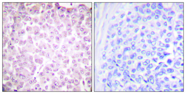 Anti-RCBTB1 antibody produced in rabbit