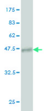 Monoclonal Anti-PIP5K1C antibody produced in