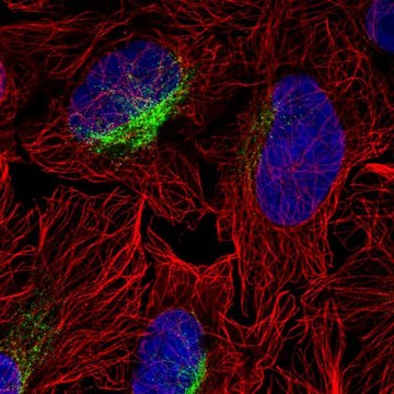 Anti-ZCCHC9 antibody produced in rabbit