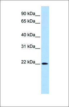 Anti-DNASE2B (ab2) antibody produced in