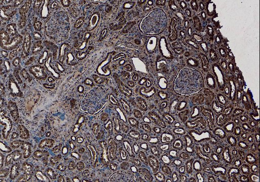 Anti-SET/I2 ? PP2A antibody produced