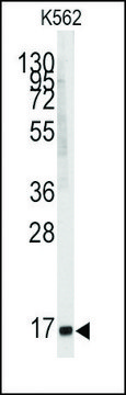 Anti-ANGEL2 (center) antibody produced in