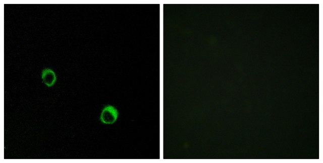 Anti-CAR14 antibody produced in rabbit
