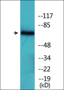 Anti-phospho-ZAP-70 (pTyr²?²) antibody produced in