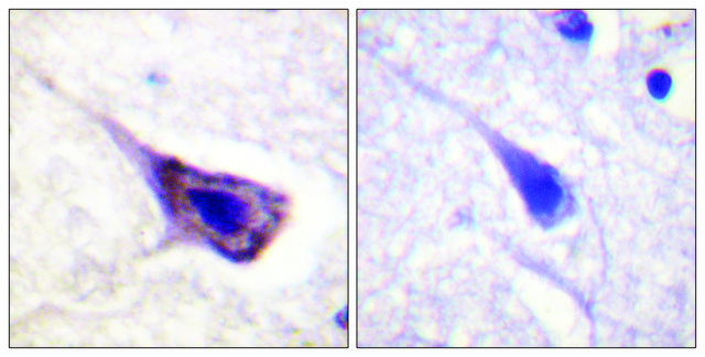 Anti-BAD antibody produced in rabbit