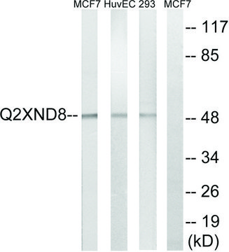Anti-Cytochrome P450 2D6 antibody produced