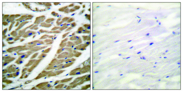 Anti-SODIUM CHANNEL-PAN antibody produced in