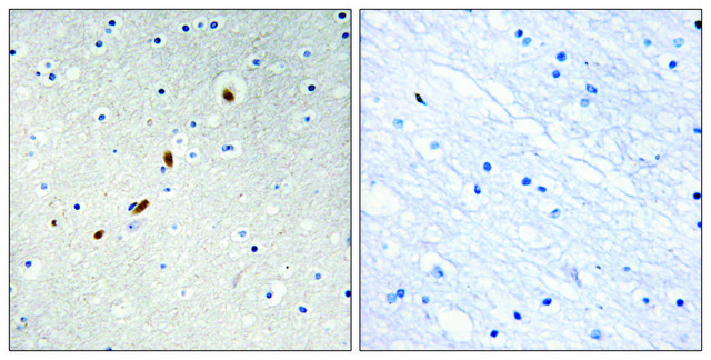 Anti-ZNF596 antibody produced in rabbit