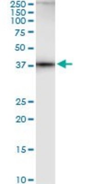 ANTI-AHCY antibody produced in mouse