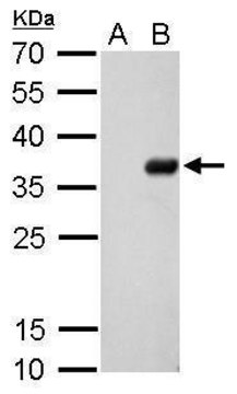 Monoclonal Anti-S Tag antibody produced