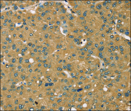 Anti-KDM5A antibody produced in rabbit
