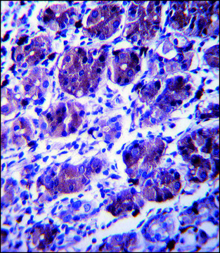 ANTI-CCDC22 (C-TERM) antibody produced in
