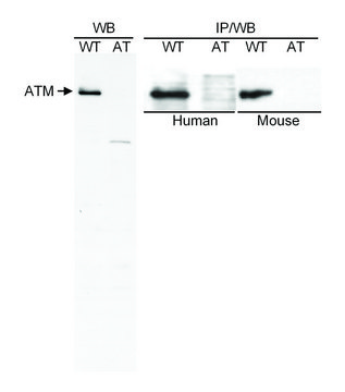 Goat anti-ATM Antibody, Affinity Purified