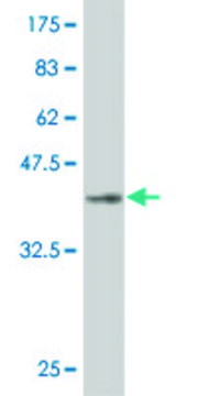 Monoclonal Anti-LHX1, (N-terminal) antibody produced