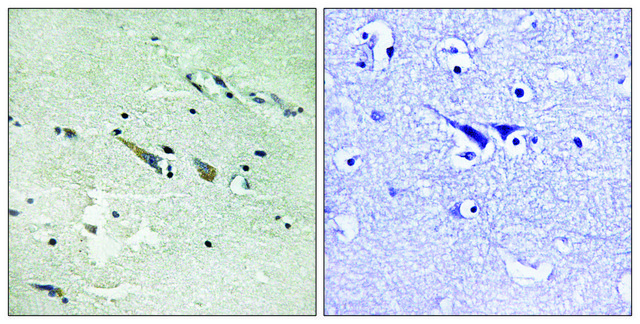 Anti-C-RAF antibody produced in rabbit