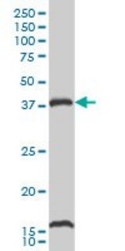 Monoclonal Anti-CAMK1, (C-terminal) antibody produced