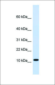 Anti-HMGN1 (ab2) antibody produced in