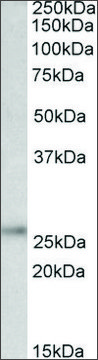 Anti-UCHL1 (C-terminal) antibody produced in