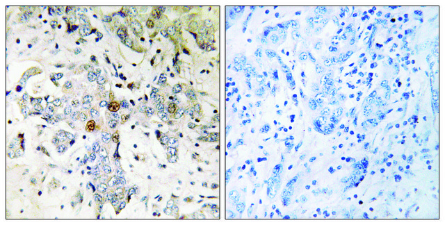 Anti-ZCCHC17 antibody produced in rabbit