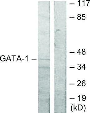 Anti-GATA1 antibody produced in rabbit