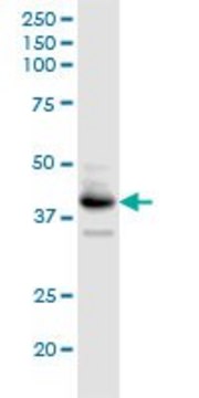Anti-B4GALT3 antibody produced in rabbit