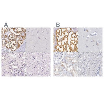 Anti-CSN1S1 antibody produced in rabbit