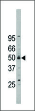 Anti-NOC2L (center) antibody produced in
