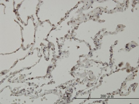 Monoclonal Anti-PIM1 antibody produced in