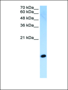 Anti-HIST2H2AC antibody produced in rabbit
