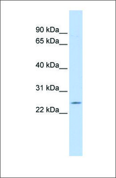 Anti-PSMB5 antibody produced in rabbit