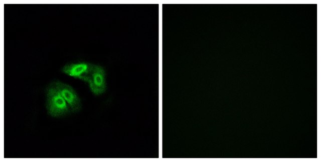 Anti-VN1R5 antibody produced in rabbit