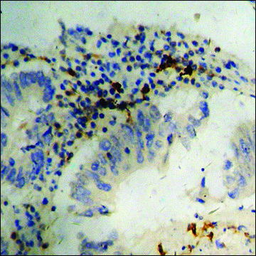 Anti-phospho-Retinoblastoma (pSer?¹¹) antibody produced in