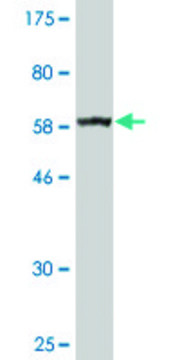 Monoclonal Anti-BDH1 antibody produced in