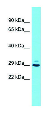 Anti-Pcsk1n (N-terminal) antibody produced in
