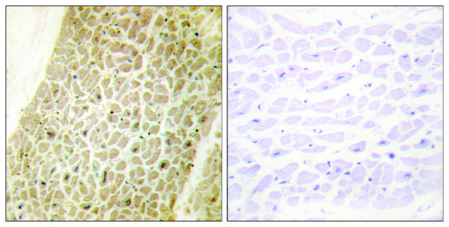 Anti-AKAP8 antibody produced in rabbit
