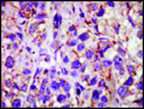 Anti-USP11 (C-term) antibody produced in