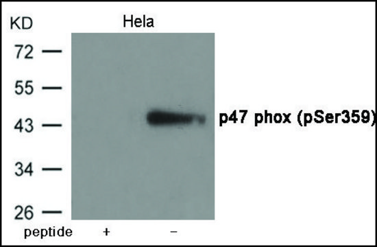 Anti-phospho-p47 phox (pSer³??) antibody produced