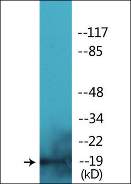 Anti-phospho-Myosin regulatory light chain 2
