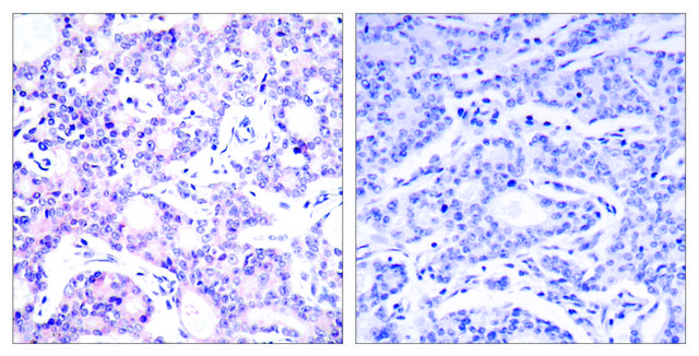 Anti-NF-?B p105 antibody produced in