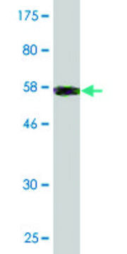 Monoclonal Anti-COL2A1 antibody produced in