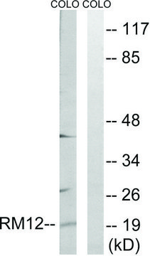 Anti-MRPL12 antibody produced in rabbit