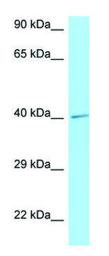 Anti-IL3RA (C-terminal) antibody produced in