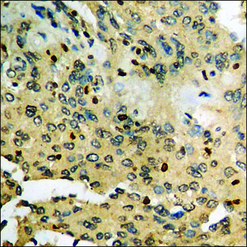 Anti-phospho-CK-1 ? (pTyr²??) antibody produced
