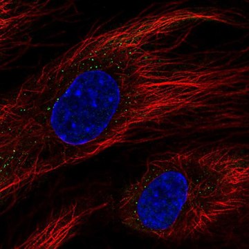 Anti-BCL6B antibody produced in rabbit