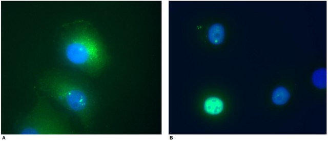 Monoclonal Anti-DAXX antibody produced in