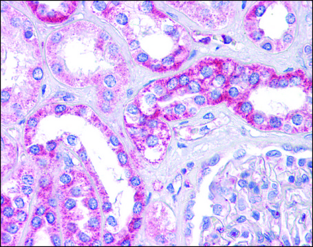 Anti-SIPA1L1 antibody produced in rabbit