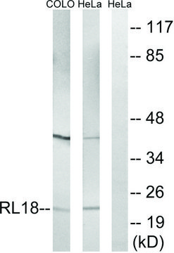 Anti-RPL18 antibody produced in rabbit